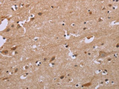ACVR2A Antibody