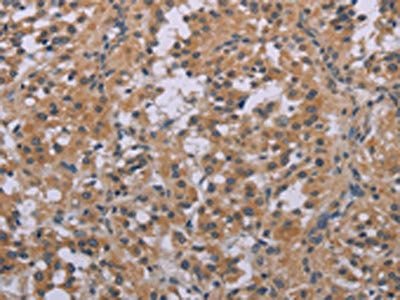 ACVR2A Antibody