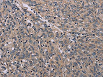 ACVR2A Antibody