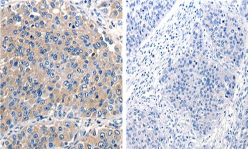 ACVR2A Antibody