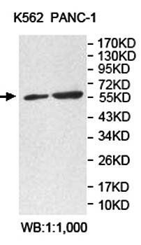 ACVR2B antibody
