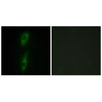 ACVRL1 antibody