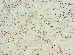 ACY1 Antibody