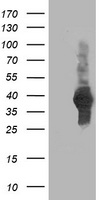 ACY3 Antibody