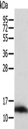 ACYP1 Antibody