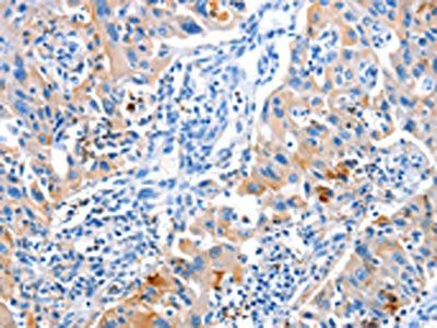ACYP1 Antibody