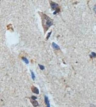 ACYP1 Rabbit Polyclonal Antibody