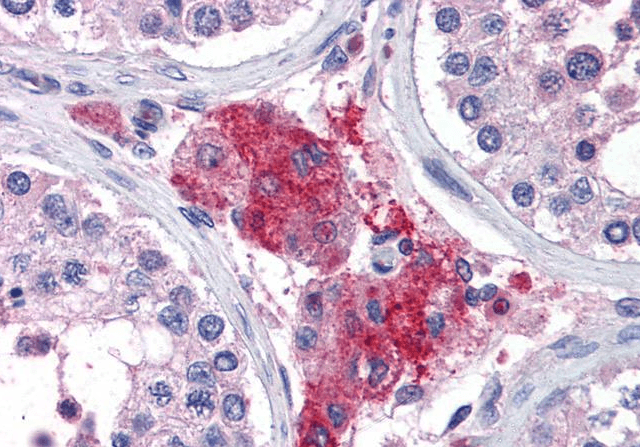 Goat anti-ACYP1 (isoform a) Antibody