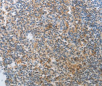 AD7C-NTP Antibody