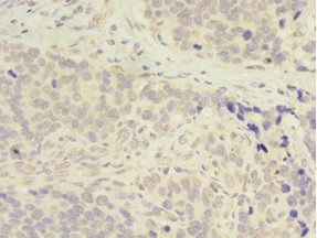 ADA Antibody