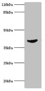 ADA antibody