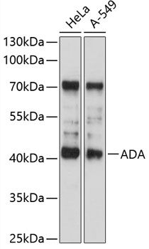ADA antibody