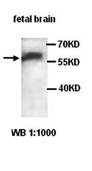 ADAM10 Rabbit Polyclonal Antibody