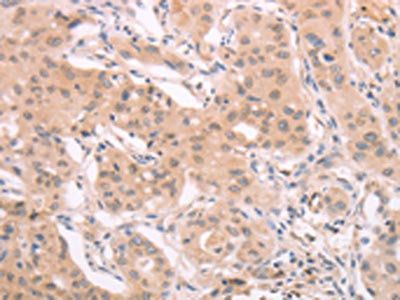 ADAM11 Antibody