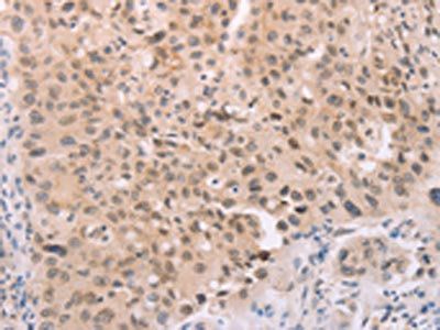 ADAM11 Antibody