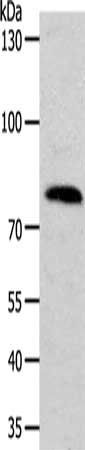 ADAM11 Antibody