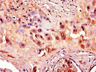 ADAM12 Antibody