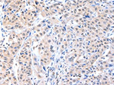 ADAM15 antibody