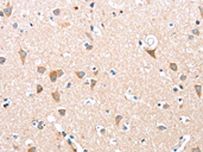 ADAM15 Antibody