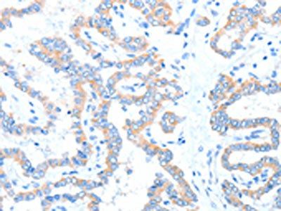 ADAM17 Antibody