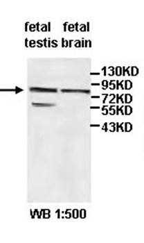 ADAM18 Rabbit Polyclonal Antibody