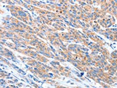 ADAM2 Antibody