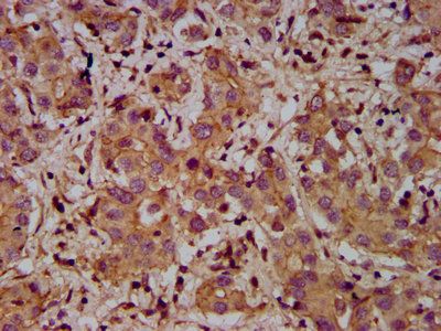 ADAM23 Antibody