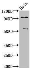 ADAM23 Antibody