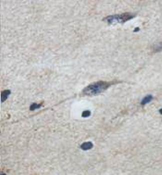ADAM23 Rabbit Polyclonal Antibody