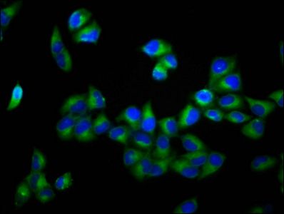 ADAM29 Antibody