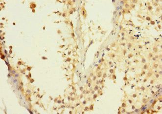 ADAM7 Antibody