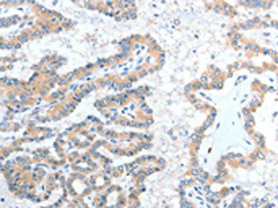 ADAM7 Antibody