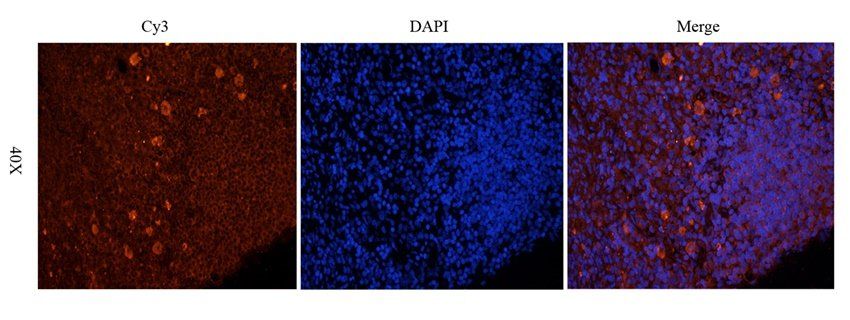 ADAM8 antibody