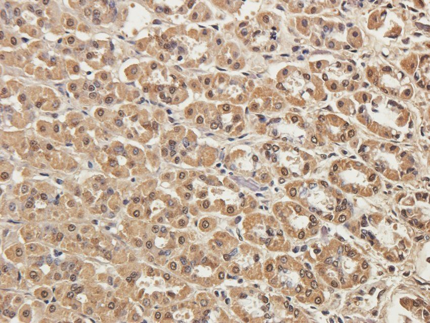 ADAM8 antibody