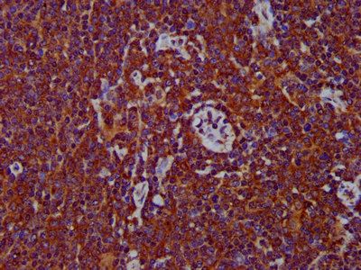 ADAM8 Antibody