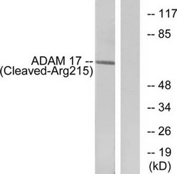 ADAM 17 (Cleaved-Arg215) Antibody