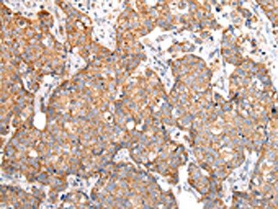 ADAMTS1 Antibody
