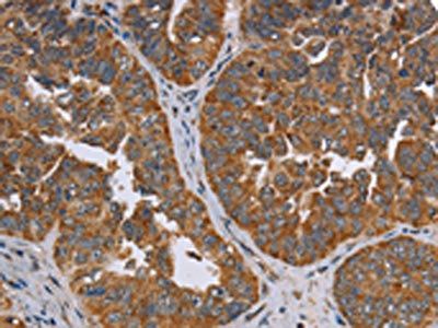 ADAMTS15 Antibody