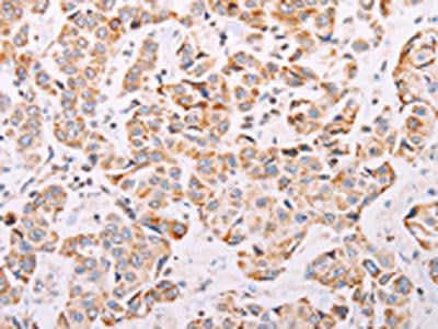ADAMTS16 Antibody