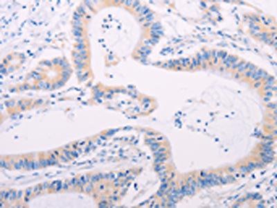 ADAMTS17 Antibody