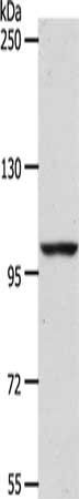 ADAMTS17 antibody