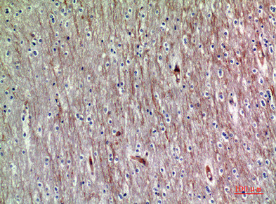 ADAMTS18 antibody