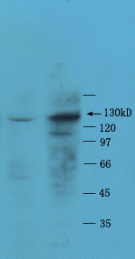 ADAMTS2 antibody