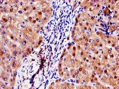 ADAMTS4 Antibody