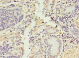ADAMTS4 Antibody