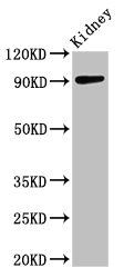 ADAMTS4 antibody