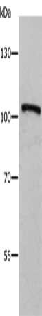 ADAMTS5 Antibody