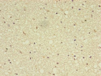 ADAMTS7 Antibody