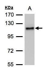 ADAMTSL2 antibody [C3], C-term