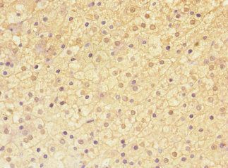 ADAMTSL4 Antibody